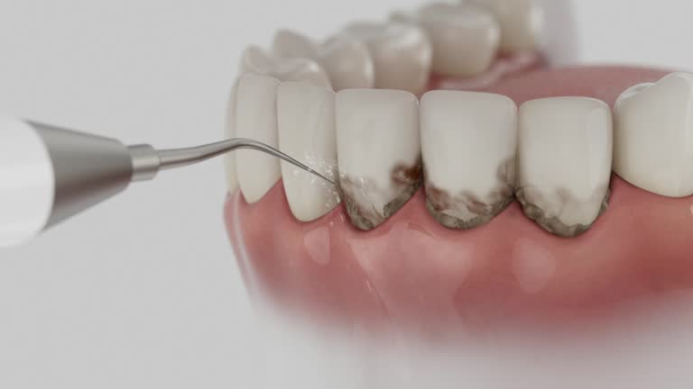 Trusted Teeth Cleaning And Checkup service in Carrier Mills, IL - Dentist Open Now